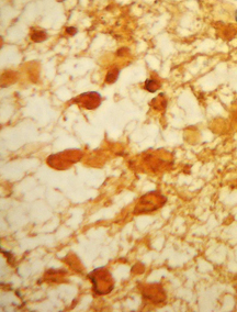 S100 Antibody