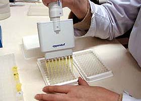 8ohdg_elisa_procedure_bunchu_multi (1).jpg