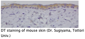 Anti dityrosine (DT) monoclonal antibody