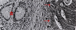 Anti 4-HNE monoclonal antibody