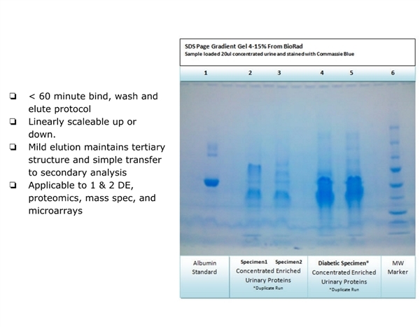 UPCK™ Urine Protein Concentration Kit尿蛋白浓缩试剂盒