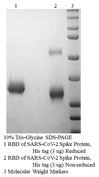 RBD of SARS-CoV-2 Spike Protein, His tag