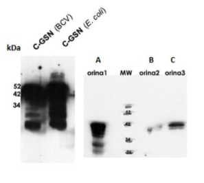 Mouse Anti-GSN (Gelsolin isoform A) monoclonal antibody