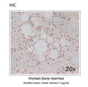 Mouse Anti-LCN2 (Lipocalin 2) monoclonal antibody