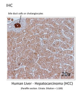 Mouse Anti-ANXA4 (Annexin A4) monoclonal antibody