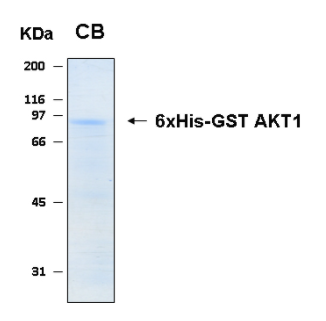 Human AKT1 recombinant protein 6xHis-GST tagged