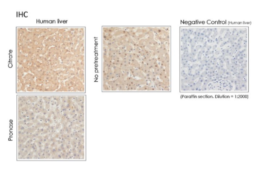 Rabbit Anti-ANXA10 (Annexin A10) polyclonal antibody