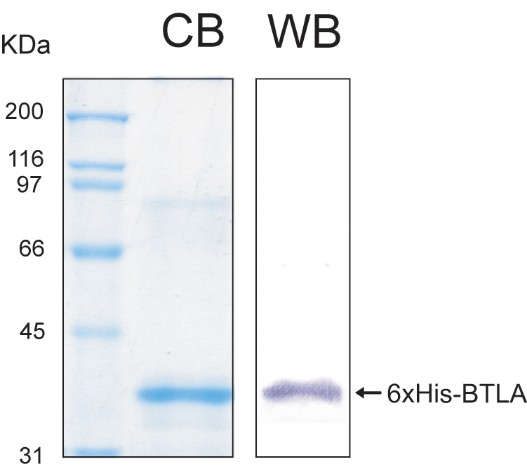 Human BTLA recombinant protein