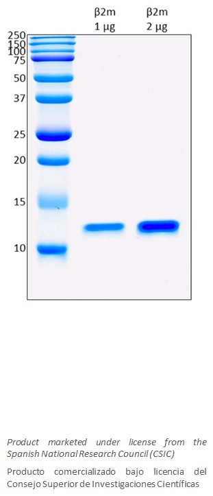 Human B2M (Human Beta-2-Microglobulin) recombinant protein