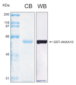 Human ANXA10 (Annexin A10) recombinant protein