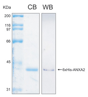 Human ANXA2 (Annexin A2) recombinant protein