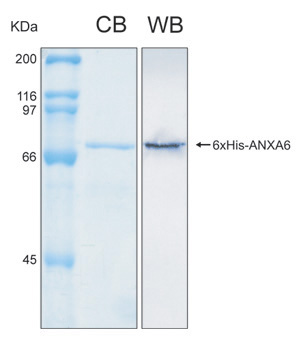 Human ANXA6 (Annexin A6) recombinant protein