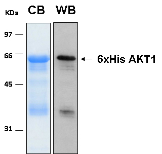 Human AKT1 recombinant protein 6xHis tagged