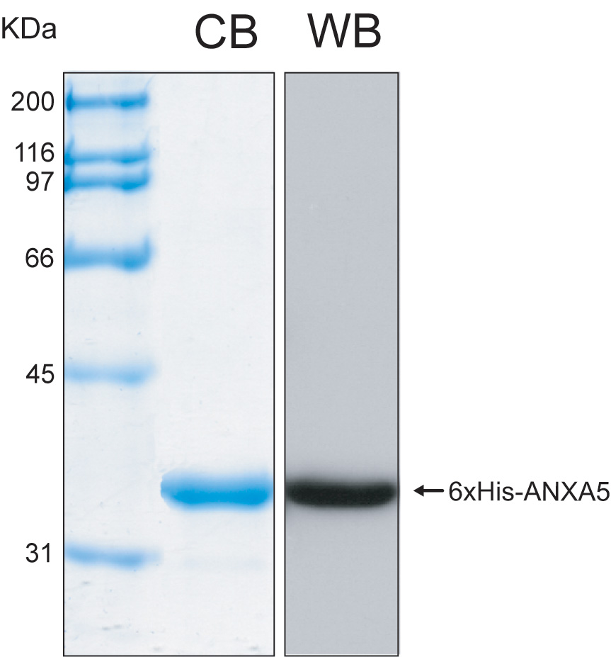 Human ANXA6 (Annexin A6) recombinant protein