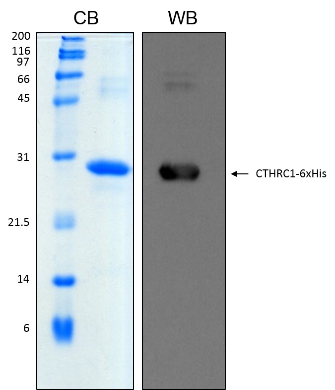 Human CTHRC1 recombinant protein