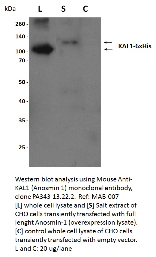 Human KAL1 Overexpression lysate product