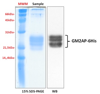 Human GM2AP recombinant protein
