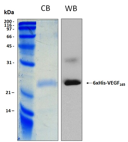 Human VEGF A isoform l, partial (165 aa),recombinant protein