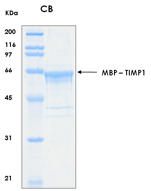 Human TIMP1 recombinant protein