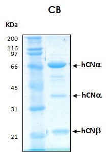 Human Calcineurin heterodimer (PPP3CA & PPP3R1) recombinant
