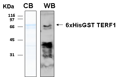 Human TERF1 recombinant protein 6xHis-GST tagged