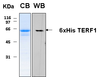 Human TERF1 recombinant protein 6xHis tagged