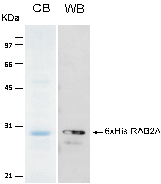 Human RAB2A recombinant protein 6xHis tagged