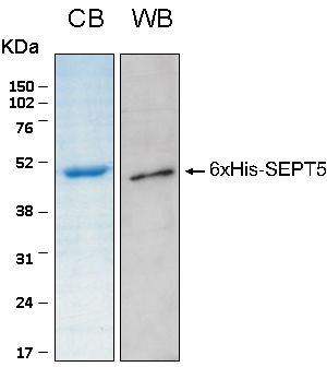 Human SEPT5 (Septin 5) recombinant protein 6xHis tagged