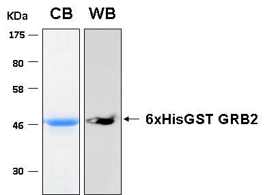 Human GRB2 recombinant protein 6xHis-GST tagged