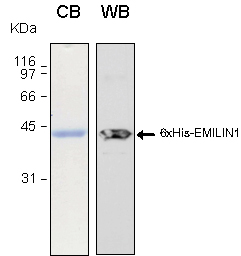 Human EMILIN1 (Emilin 1) recombinant protein 6xHis tagged
