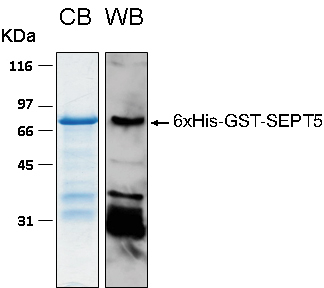 Human SEPT5 (Septin 5) recombinant protein 6xHis-GST tagged