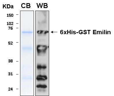 Human EMILIN1 recombinant protein 6xHis-GST tagged