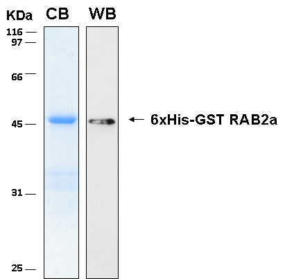Human RAB2A recombinant protein 6xHis-GST tagged