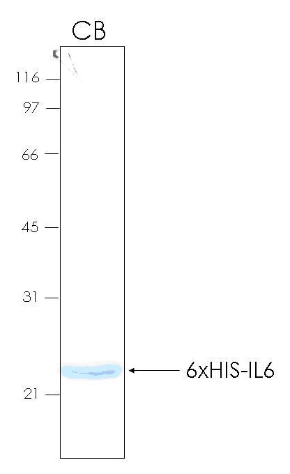 Human IL6 (Interleukin 6) recombinant protein