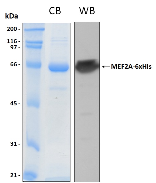 Human MEF2A recombinant protein