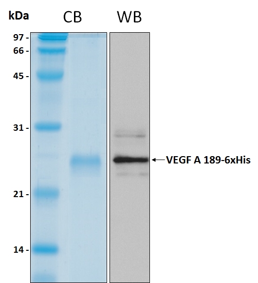 Human VEGF A isoform 189 recombinant protein