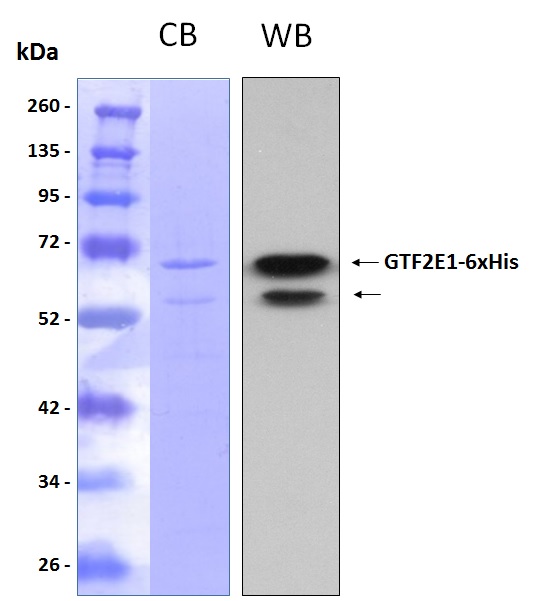 Human GTF2E1 recombinant protein