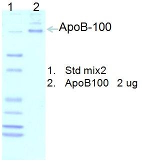 Human Apolipoprotein B-48/100(Apo B-48/100) 人载脂蛋白B-48/100