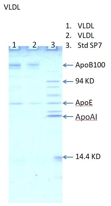人极低密度脂蛋白Human Very Low Density Lipoprotein(VLDL)(50%甘油溶液)