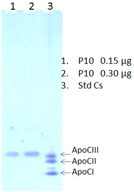 Human Apolipoprotein CIII(Apo CIII) 人载脂蛋白CIII