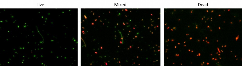 Cell Meter™ Bacterial Viability Assay Kit