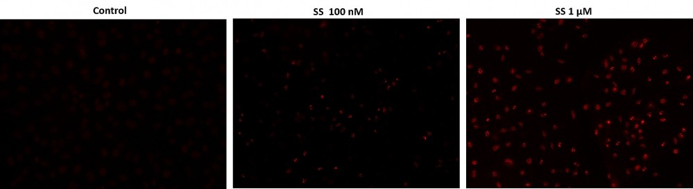 Cell Meter™ TUNEL Apoptosis Assay Kit *Red Fluorescence*