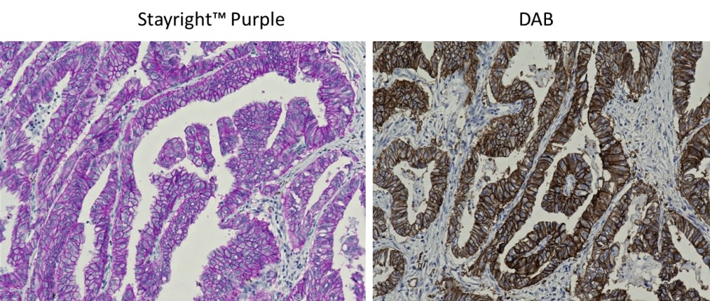 Stayright™ Purple HRP Staining KIt