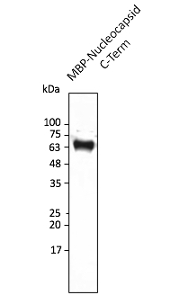 Anti-Nucleocapsid (SARS-CoV-2) Antibody
