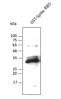 Anti-Spike RBD Domain (SARS-CoV-2) Antibody