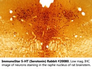 5-HT (Serotonin) Rabbit Antibody